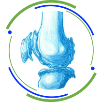 Infiltrações para joelho 1 dr_marcelo_corvino_ortopedia_geral_especialista_cirurgia_do_joelho_icone_ortopedia_geral_artrose_do_joelho